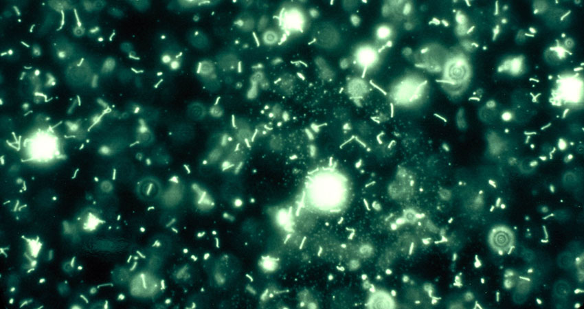 Darkfield Microscopy